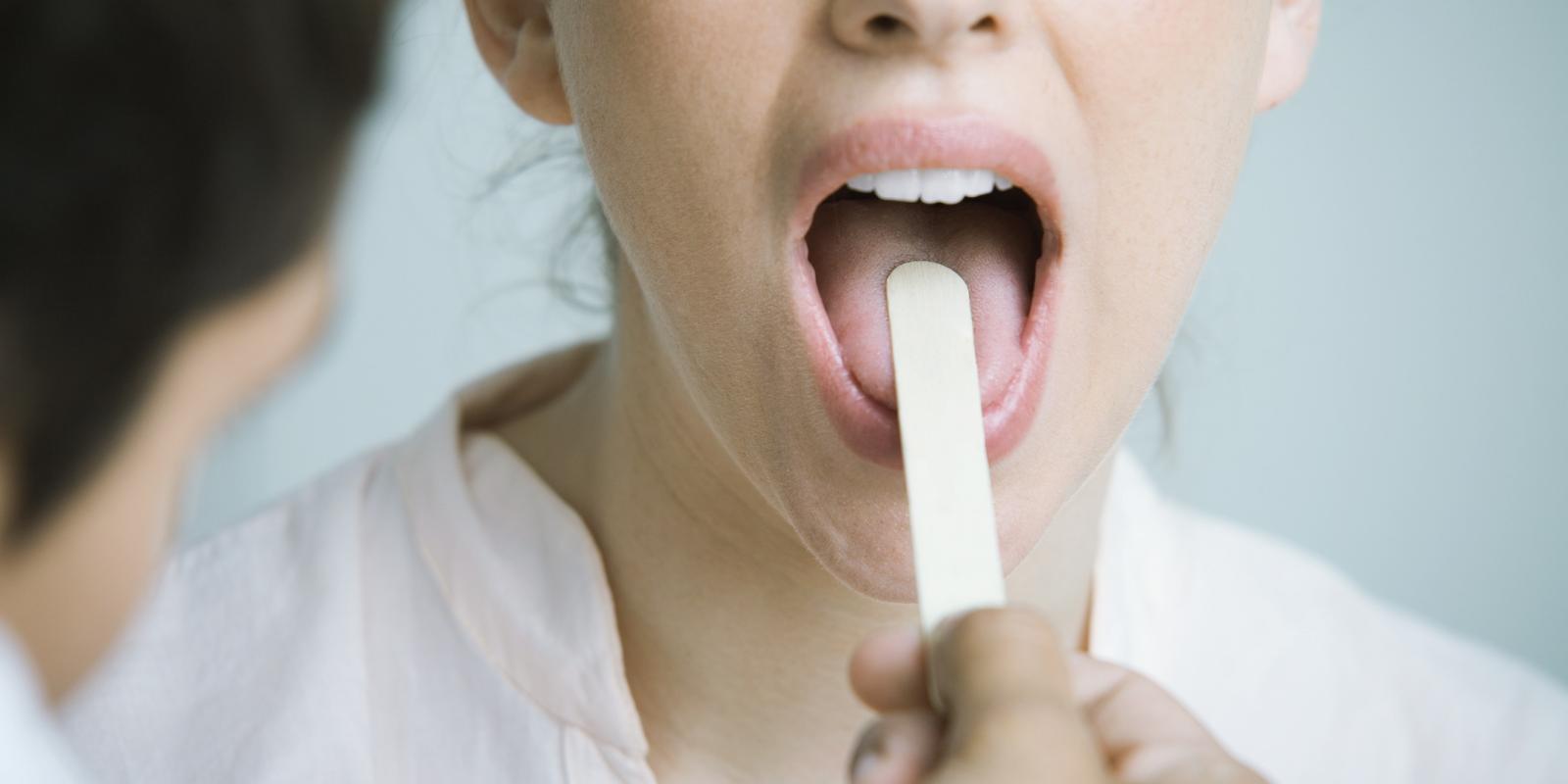 Bilde av at noen legger en tungespatel på tungen til en hvit dame